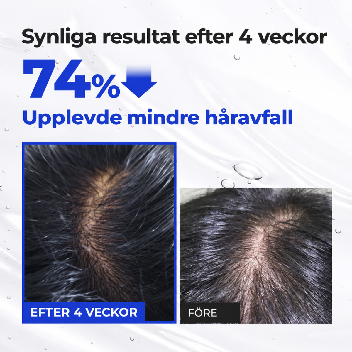 EPAIS – Hårbottenserum med borstapplikator, 150 ml