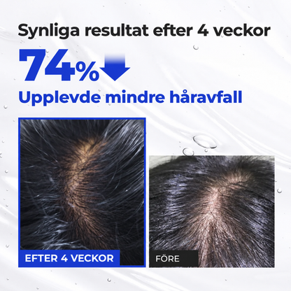 EPAIS – Hårbottenserum med borstapplikator, 150 ml